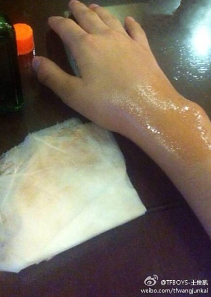 米兰体育：篮球运动损伤的预防：科技手段如何降低受伤风险？的简单介绍